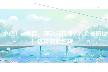 小心！60岁后，颈动脉几乎100%会长斑块！这样做能逆转→